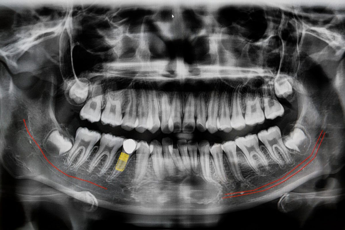 Imagem ilustrativa de Radiologia Odontológica